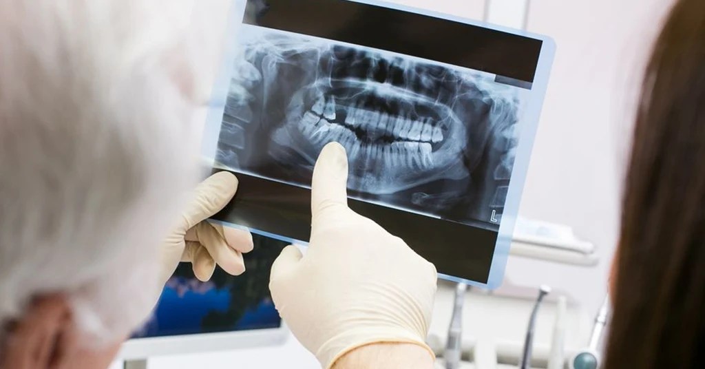 Faktor yang Mempengaruhi Harga X Ray Gigi Klinik Swasta Faktor yang Mempengaruhi Harga X Ray Gigi Klinik Swasta