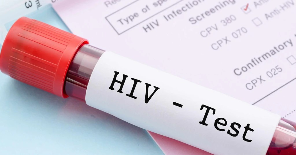 Jenis HIV Test Jenis HIV Test