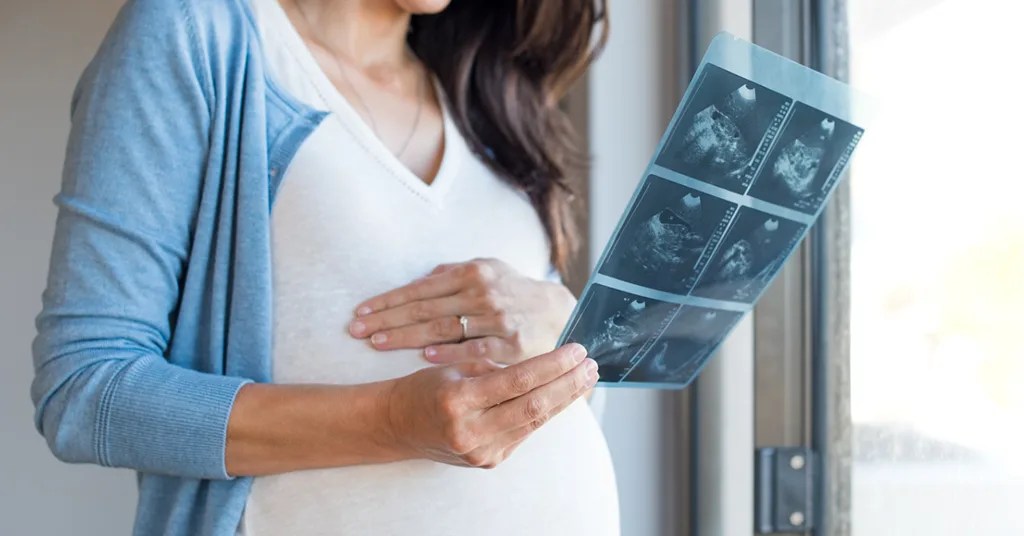 Kelebihan Scan Baby di Klinik Mediviron Kelebihan Scan Baby di Klinik Mediviron