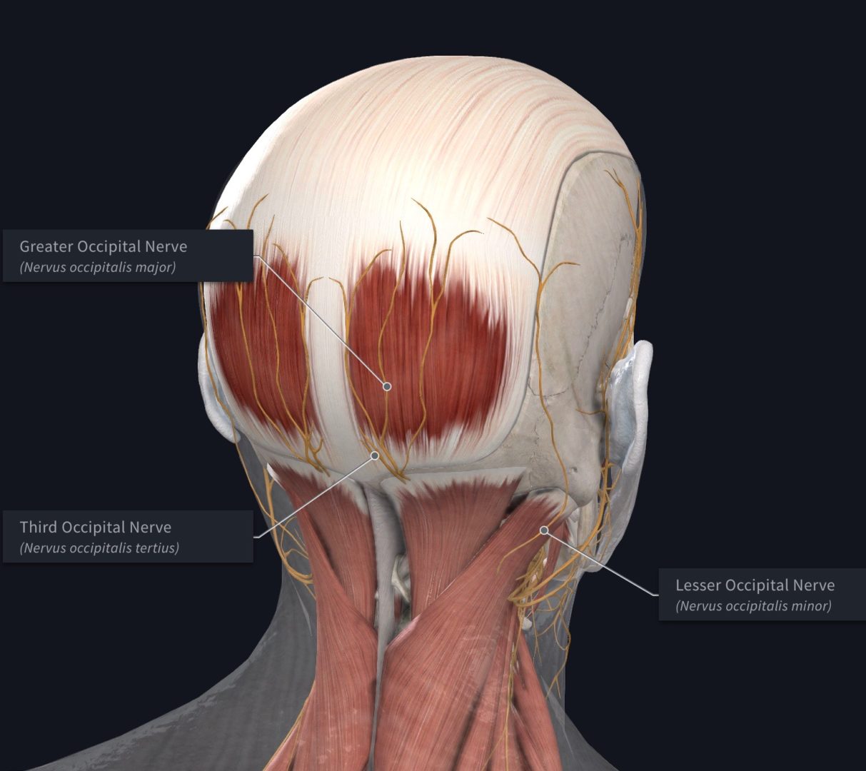 Occipital neuralgia treatment ca