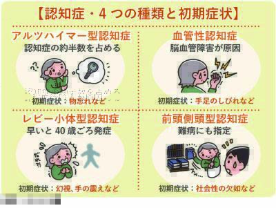 認知症による困った行動の改善を目指す 気功特別個人セッション