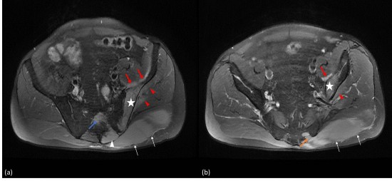 Centre D Imagerie Osteo Articulaire Clinique Du Sport De Bordeaux