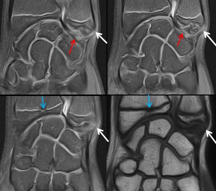 Centre d&rsquo;imagerie Ostéo-Articulaire | Clinique du sport de Bordeaux