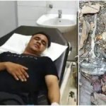 Muhammad Yudhi (36), warga Gampong Lamteh, Kecamatan Ulee Kareng, Banda Aceh terpaksa kehilangan kedua daun telinganya usai dianiaya oleh dua pria, Minggu subuh (12/5/2024). (Foto: Dok Polresta Banda Aceh)
