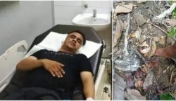 Muhammad Yudhi (36), warga Gampong Lamteh, Kecamatan Ulee Kareng, Banda Aceh terpaksa kehilangan kedua daun telinganya usai dianiaya oleh dua pria, Minggu subuh (12/5/2024). (Foto: Dok Polresta Banda Aceh)