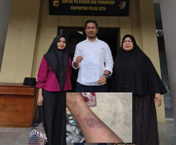 Layyina Miska asal Desa Lhokmambang, Kecamatan Gandapura Bireuen selaku korban penganiayaan didampingi kuasa hukumnya melaporkan salah satu anggota polisi berinisial KM ke Propam Polda Aceh. (Foto: Ist)