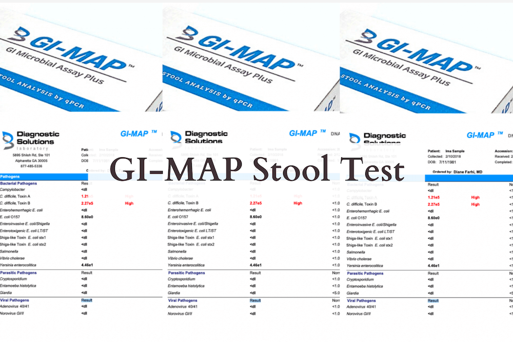 Is A GI MAP Test Worth It Gut Test Explained In On Around GI MAP Stool Test 