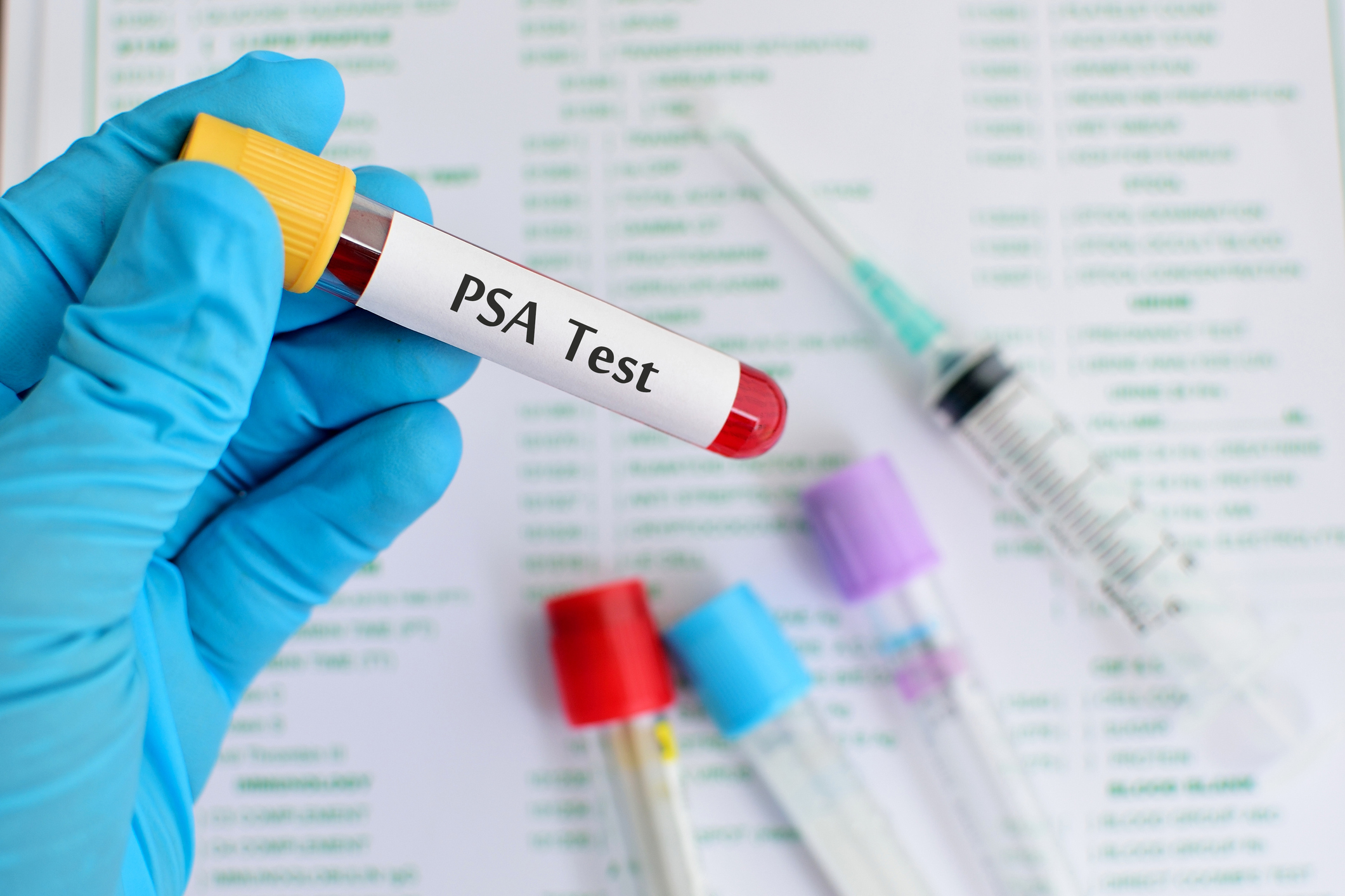 PSA Milestone: The Key to Predicting Survival in Metastatic Prostate Cancer (2026)
