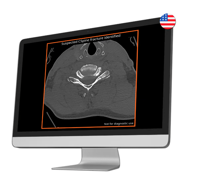 Ferramenta de IA recebe aprovação para detecção de fraturas na coluna cervical
 #ÚltimasNotícias