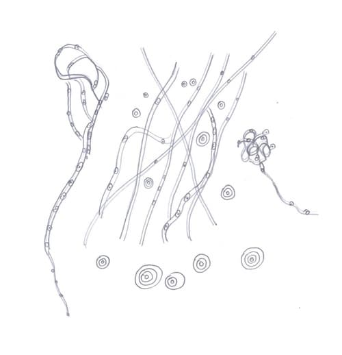 What Exactly are Eye Floaters? Jim On Light