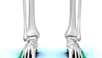 Fifth metatarsal bone