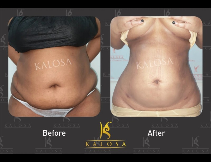 Patient Result