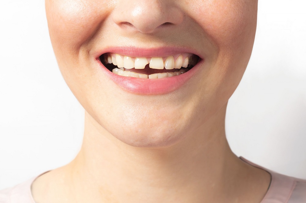 What happens if half of your tooth breaks off?