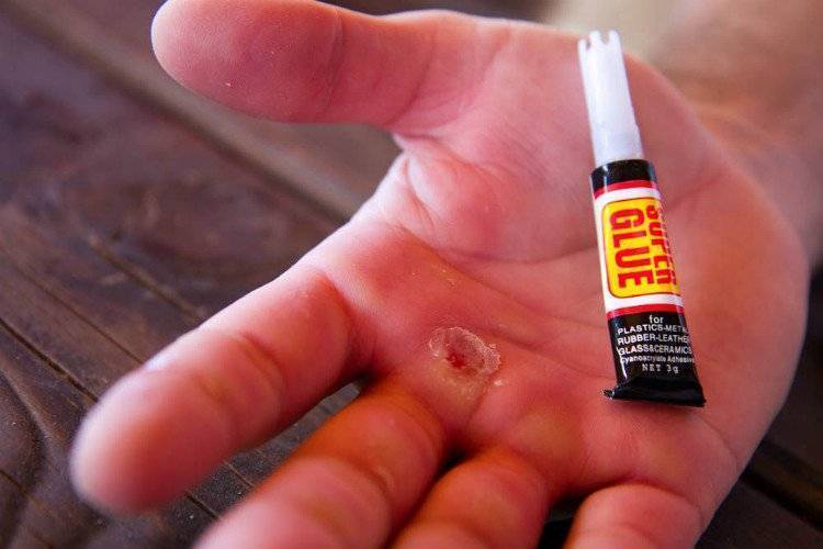 MedicalSuperglue Kids World Fun Blog