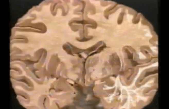 Inquire about professional development or get … The split brain: a tale of two halves Â« Kurzweil