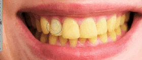How to Whiten Teeth in Photoshop (Tutorial) (2024 UPDATED) (16) How to Whiten Teeth in Photoshop (Tutorial) (2024 UPDATED) (16)