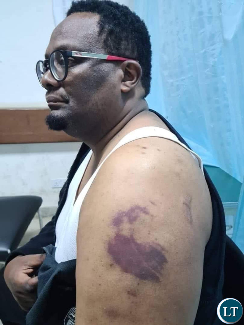 Zambia : Opposition Leaders Express Concern Over Human Rights Abuses in Zambia - Vimarsana News