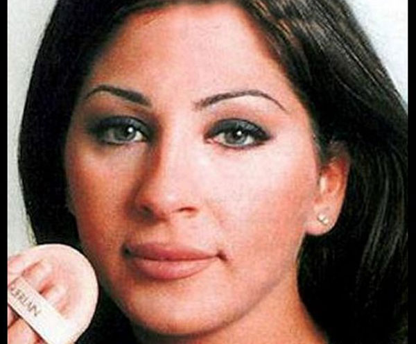 picture اليسا قبل عمليات التجميل يوتيوب Ù
شاÙÙØ±
