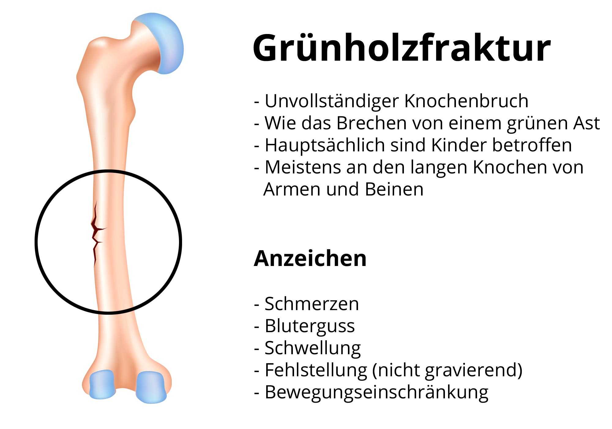 Most of these fractures are nondisplaced and heal uneventfully. Grunholzfraktur Ursache Behandlung Prognose