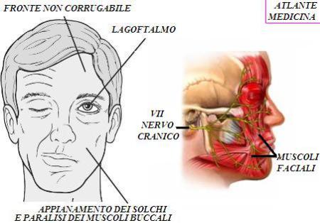 Con chiusura a strappo che assicura una corretta compressione sul viso e sul mento. Emiparesi facciale: quando le emozioni degli altri