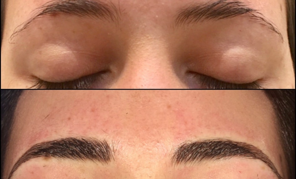 2 Nouvelles Techniques De Pigmentation Pour Avoir Des Sourcils Parfaits