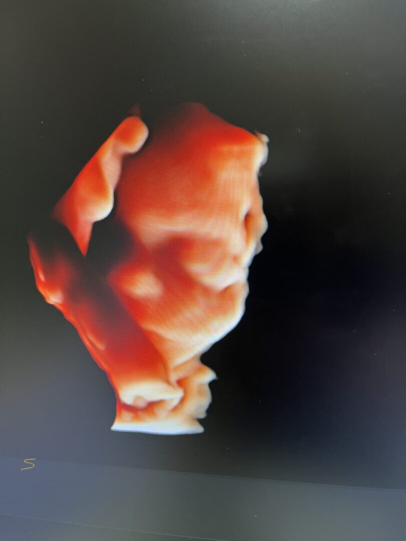 كرت موسيقي متحرك للجنين