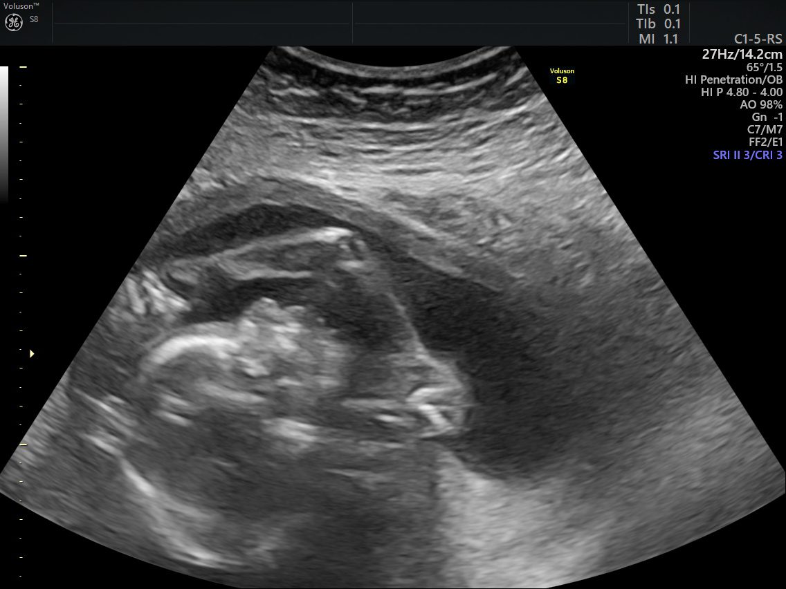 صور جنين حلوة