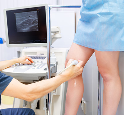 Doppler Ultrasound for DVT
