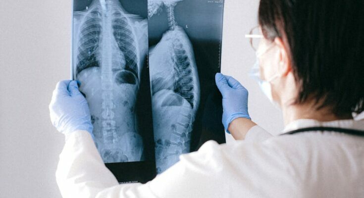 A doctor holding an x ray result