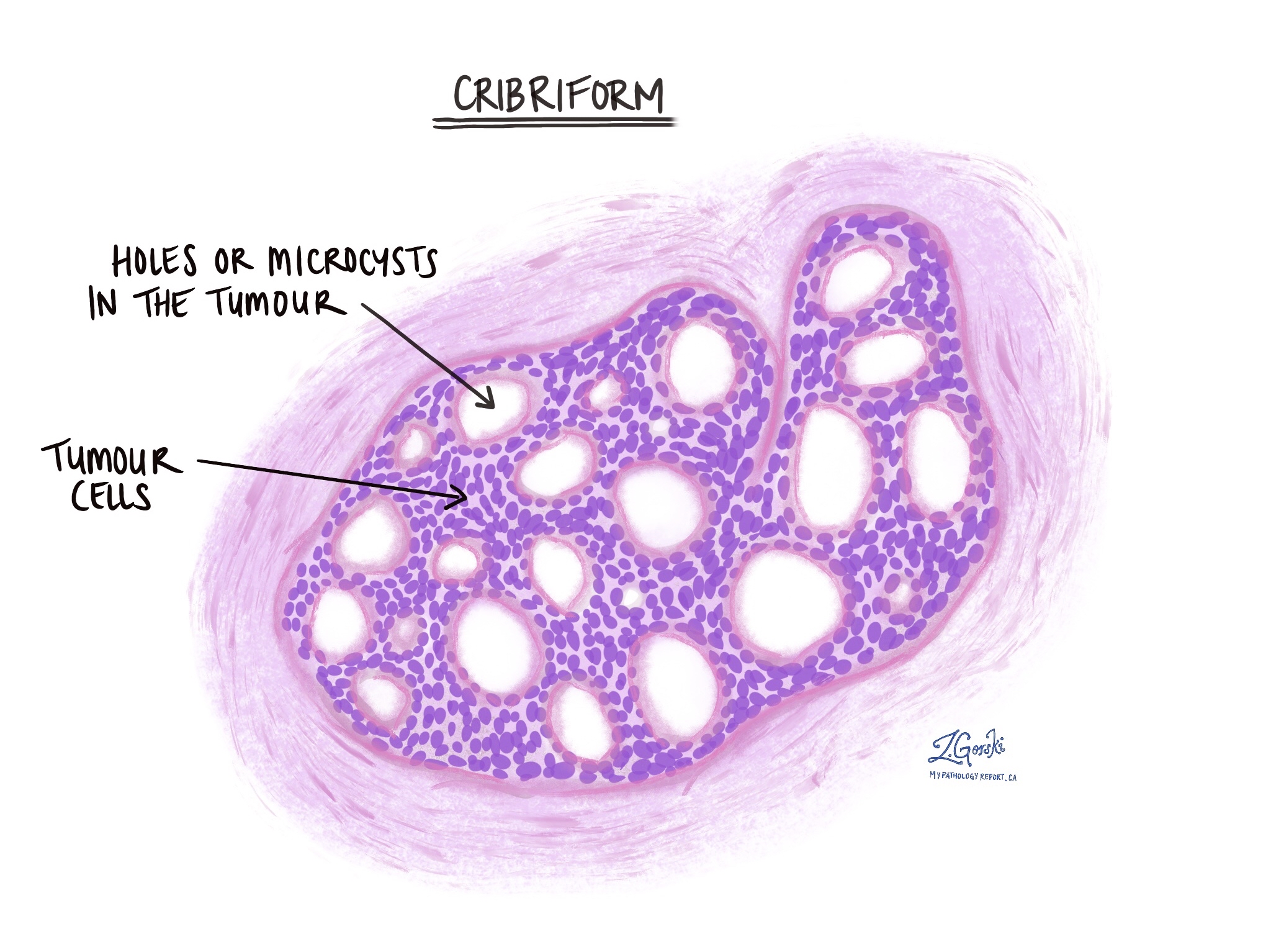 Лактирующая молочная железа гематоксилин эозин. Гистология молочной железы что это. Гистология молочной железы что это. Молочная железа строение гистология. Эпителий протока молочной железы.