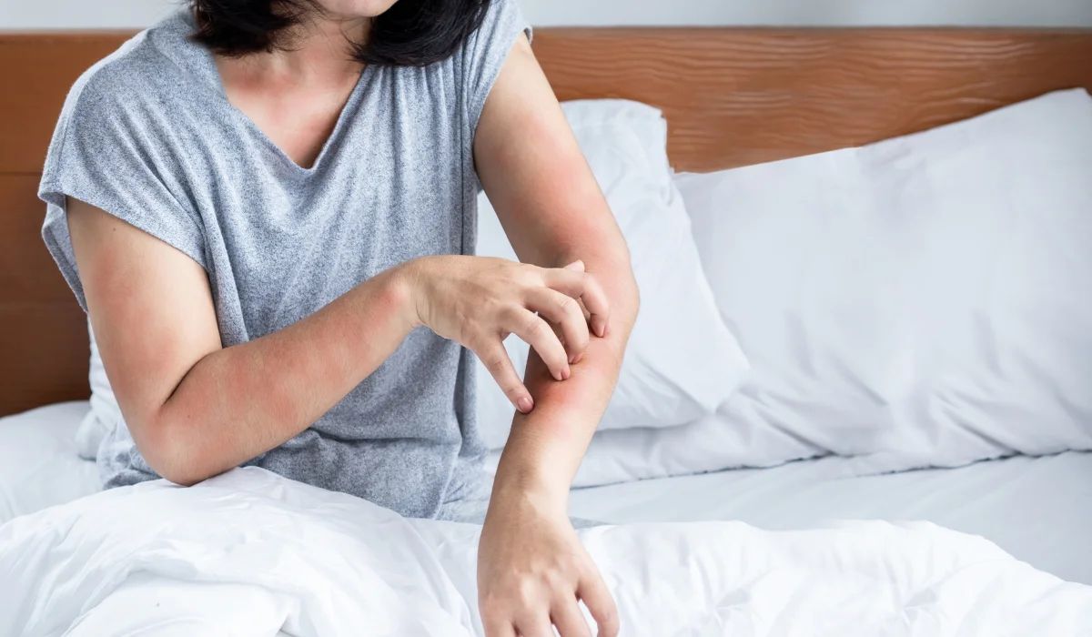 Forearm and upper arm with multiple red, itchy bite marks forming a short, loose line as the person scratches