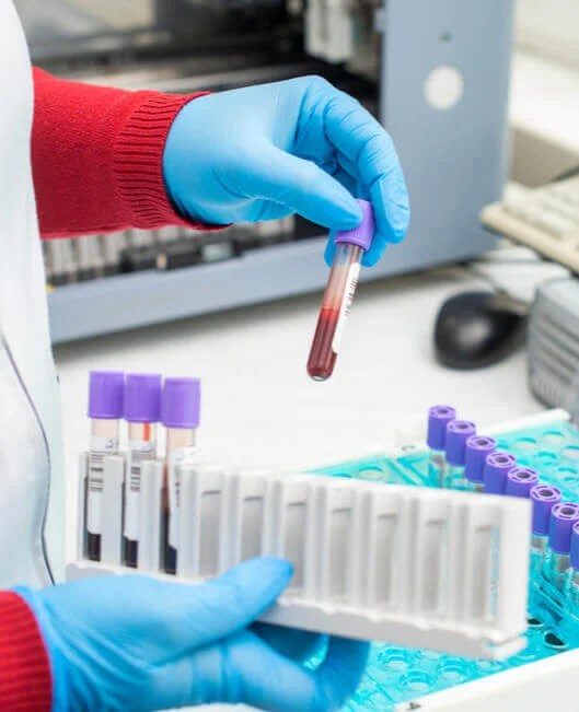 Biomarker Lab CRO, Biomarker Testing Services, Biomarker Assays