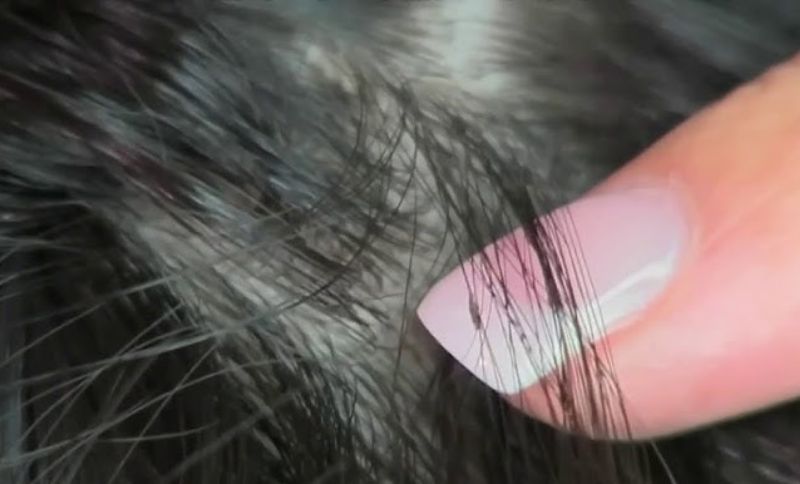 Head lice tips for back-to-school season: How to protect your kids