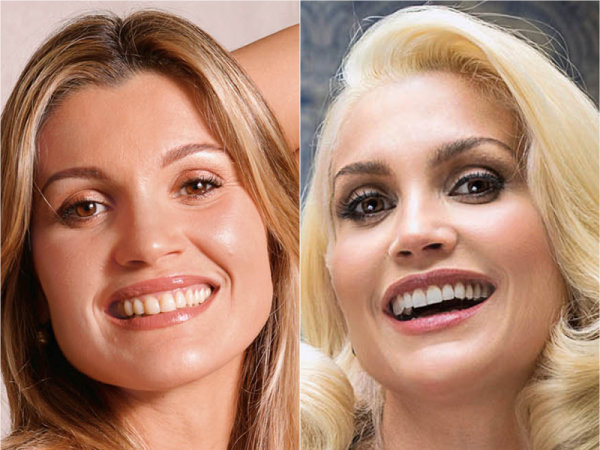 18.10.2021 · venerdì 22 ottobre 2021 uscirà il nuovo disco di alessandra amoroso, tutto accade, che contiene tutte le volte, piuma e sorriso grande. 10 Famosos brasileiros que mudaram o sorriso com lentes de