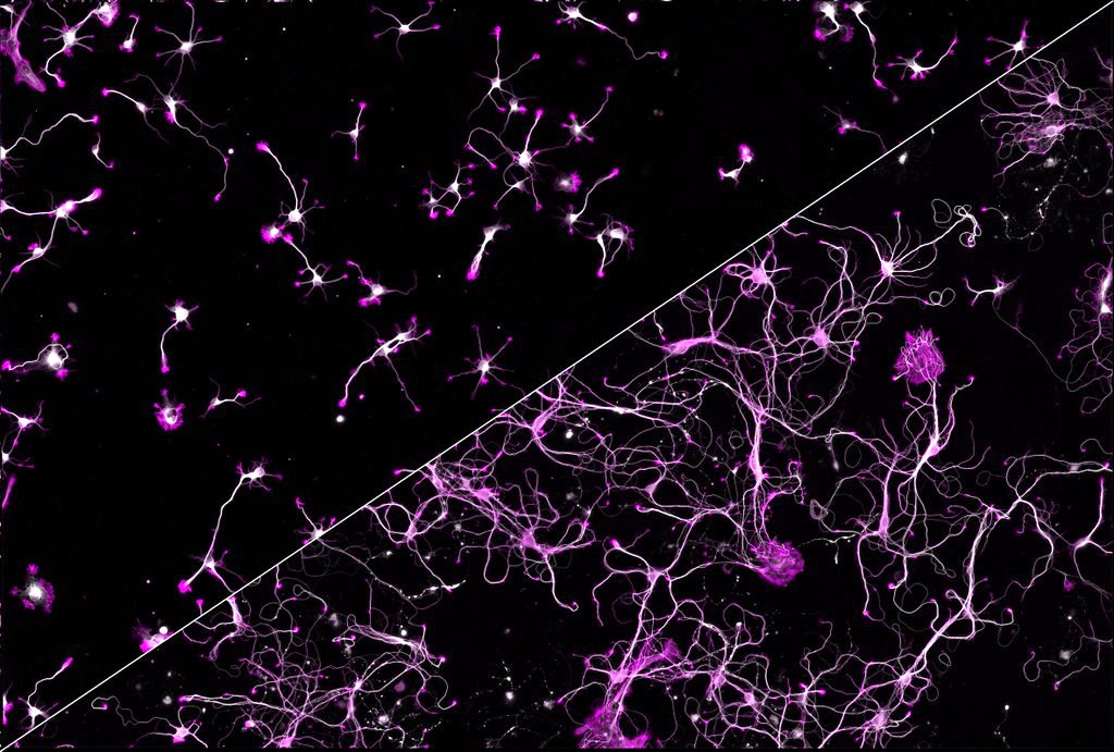Neuronal culture at 2 days (top left) and 9 days (bottom right), labeled for actin (magenta) and microtubules (grey)