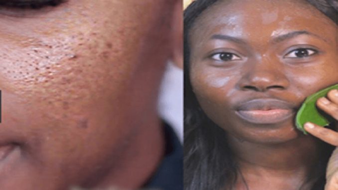 How To Get Smooth Skin Without Applying Chemicals In Few Days These Tips Work Like Magic On Your Face Newsflashngr