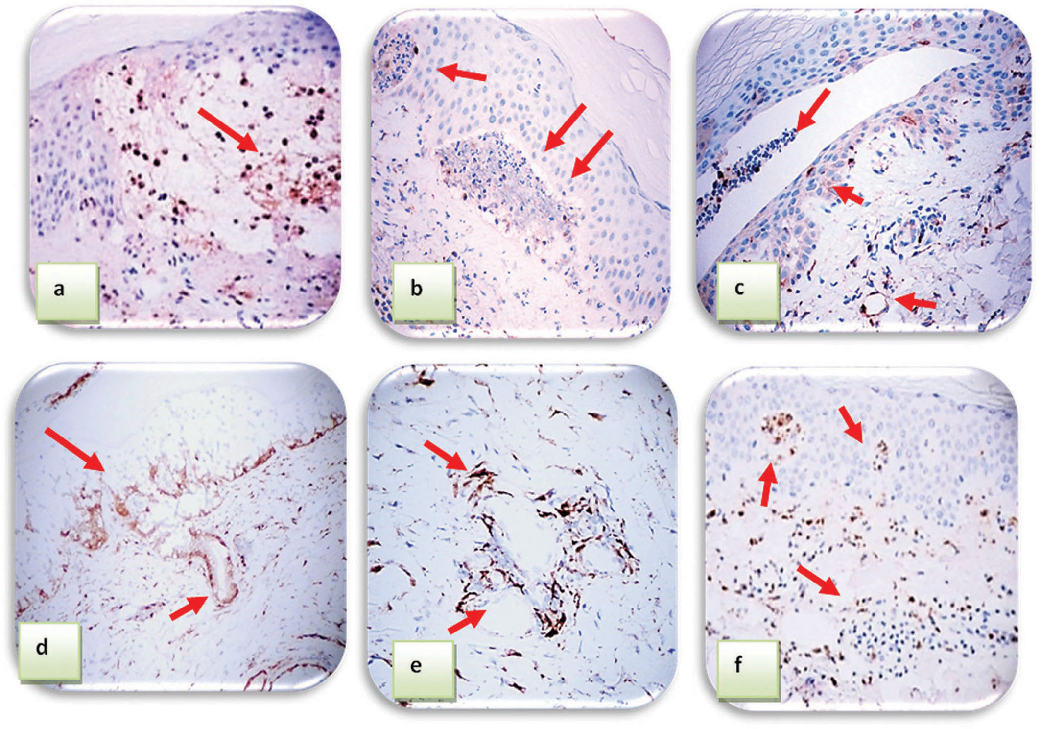 2013 3 3 Tissue Our Dermatology Online Journal