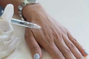 Ästhetische Dermatologie 27 Handfiller - Handverjüngungsverfahren