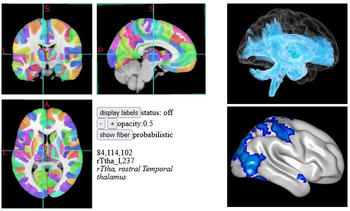 Image showing widespread thalamic connectivity