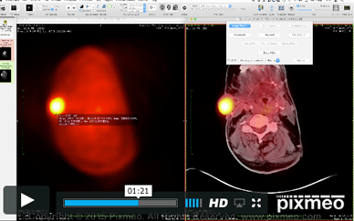 No matter what you call it, consider this your health guide to everything about your butt. Osirix Dicom Viewer Tutorials