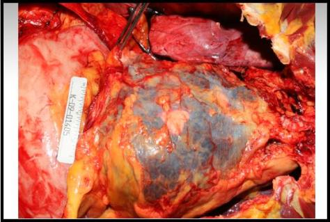 Forensics Part 1, Question #8