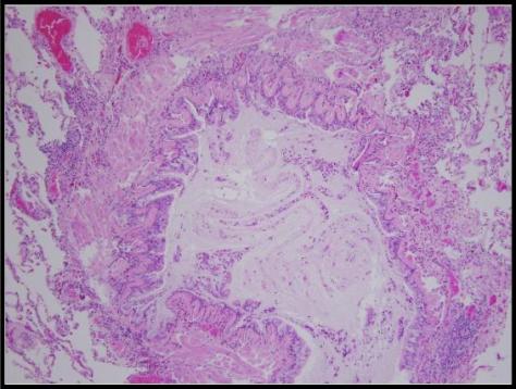 Forensics Part 1, Question #9