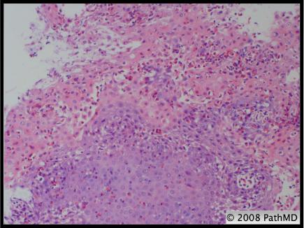 Gastrointestinal Pathology - Part 7, Question #1