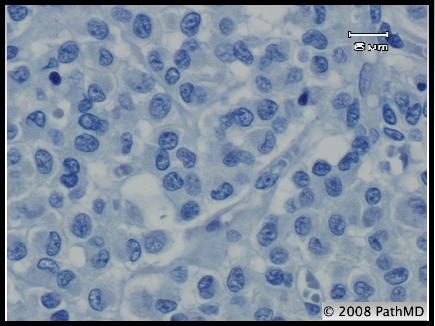 Gastrointestinal Pathology - Part 7, Question #7
