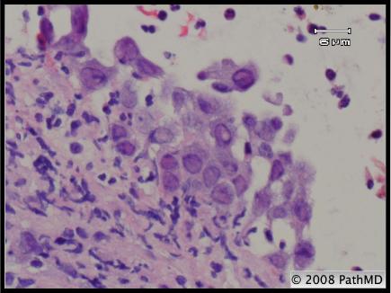 Gastrointestinal Pathology - Part 6, Question #2