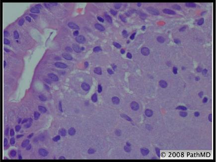 Gastrointestinal Pathology - Part 6, Question #9