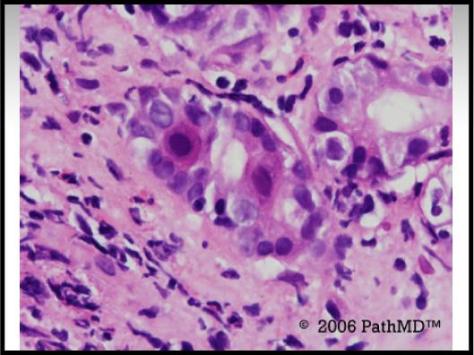 Gastrointestinal Pathology - Set 2, Case #2
