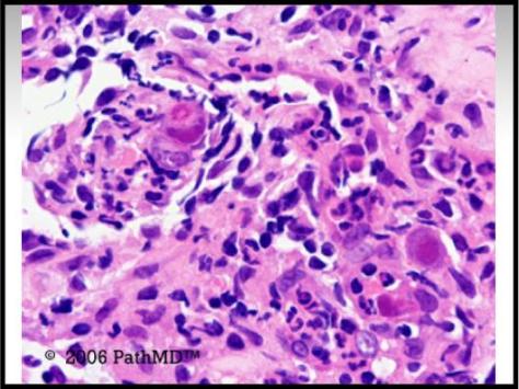 Gastrointestinal Pathology - Set 2, Case #8