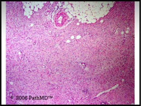 Gastrointestinal Pathology - Set 2, Case #9
