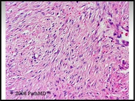 Gastrointestinal Pathology - Set 2, Case #9